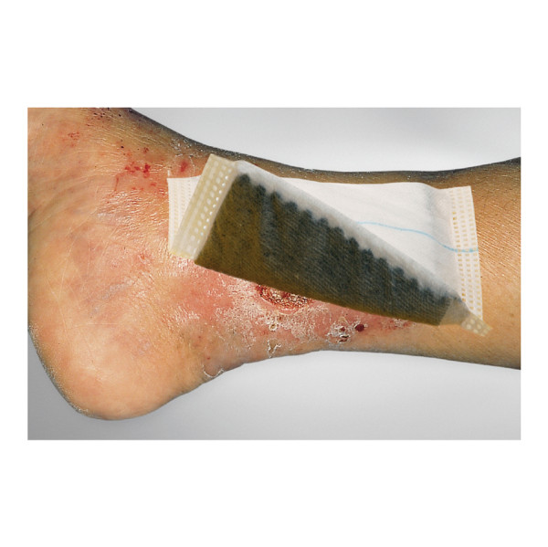 lohmann-rauscher-vliwaktiv-ag-aktivkohle-tamponade-10x15cm-20702.jpg